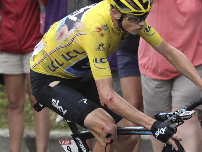 Chris Froome, with torn yellow jersey, bleeds after his crashing during the 19th stage